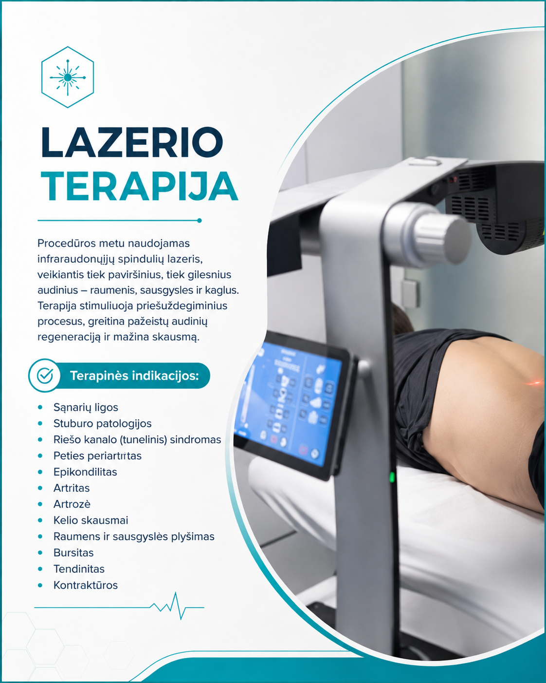 Lazerio terapijos procedūros informacinis maketas